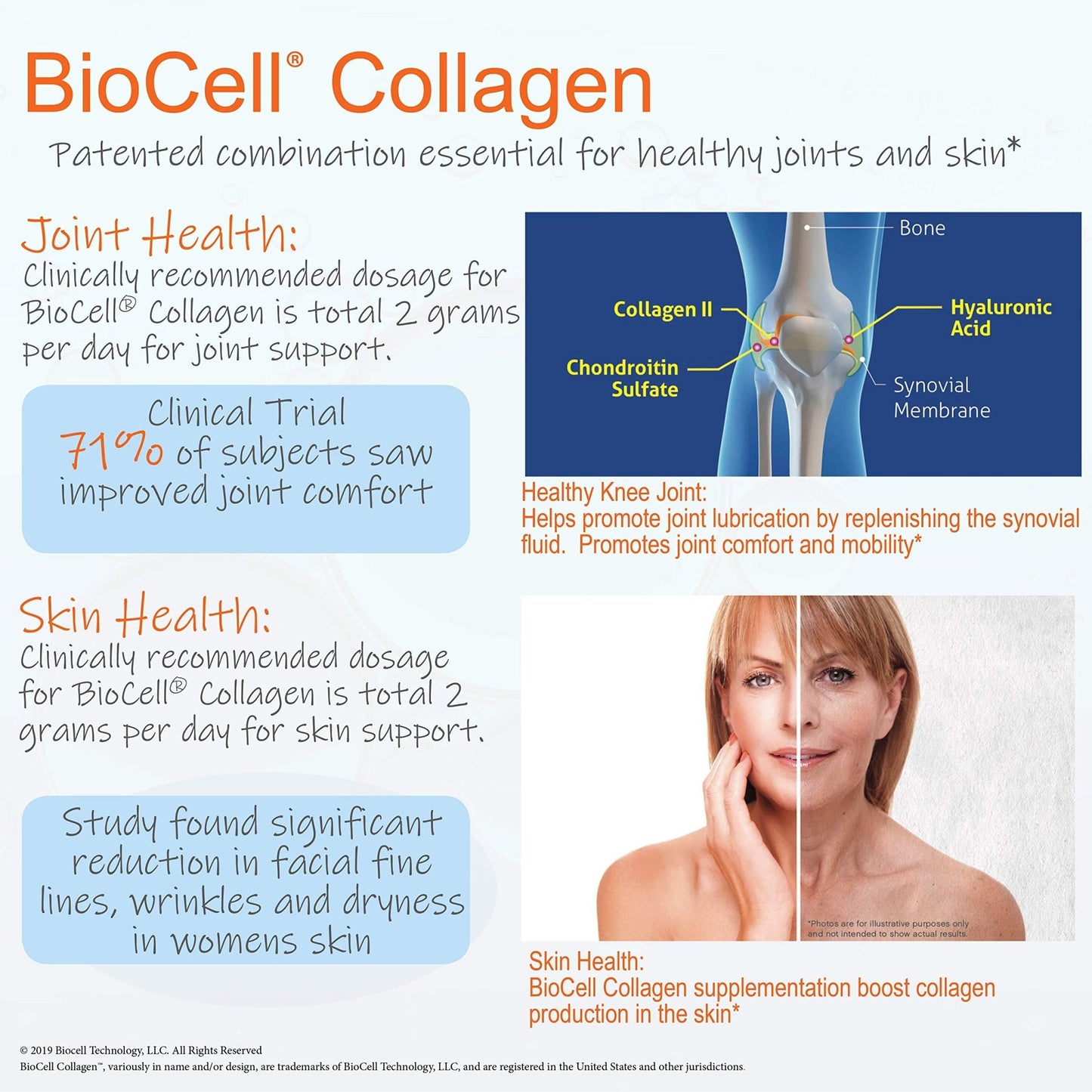 Doctor's Best Glucosamine Chondroitin MSM + Hyaluronic Acid with OptiMSM Featuring Biocell Collagen, Joint Support, Non - GMO, Gluten & Soy Free, 150 Caps - Fresh Hearth